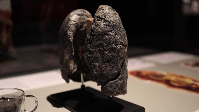 Smoking damage human lungs close up diseased organ comparison with healthy tissue medical exhibit addiction risk respiratory health concept