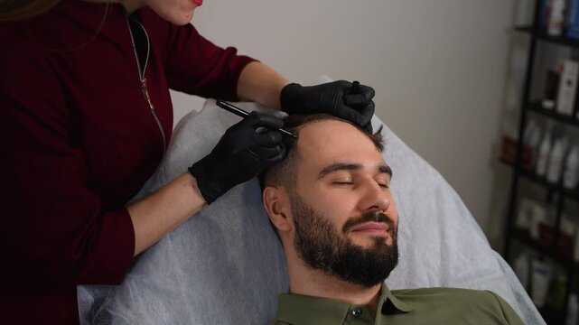Hairline micropigmentation procedure for male baldness treatment