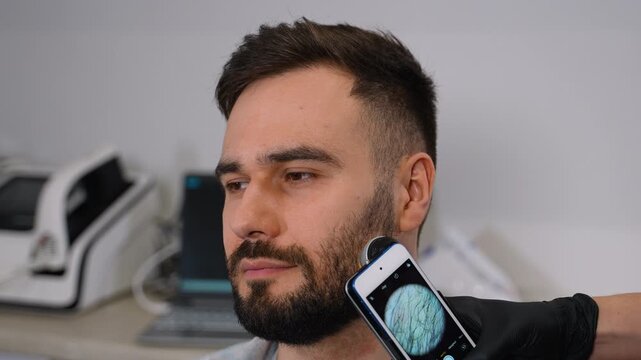 Dermatologist examining man's beard with trichoscope