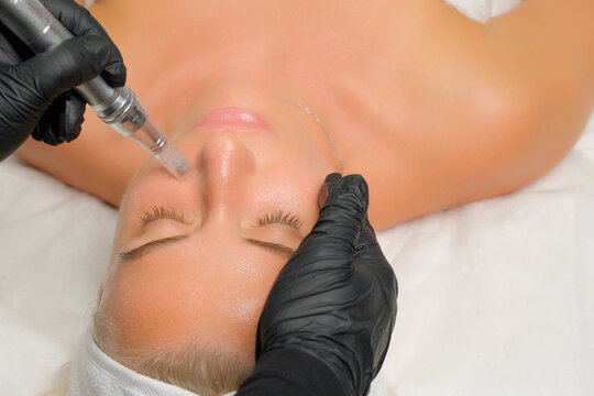 Woman receiving microneedling treatment on her face for skin care at a beauty clinic
