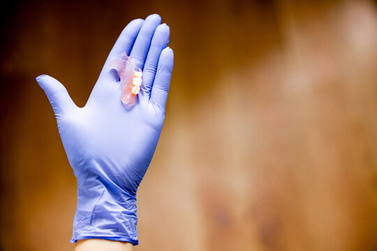 Dental partial removable plate denture in dentist hand demonstrating prosthetic solution for missing teeth highlighting orthopedic dentistry restoration and prosthetic treatment