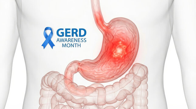 Gerd awareness month stomach acid reflux gerd awareness month stomach acid reflux gerd awareness month stomach acid reflux gerd awareness month stomach acid reflux