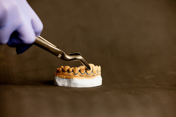 Dental bayonet instrument holding plaster upper jaw model on dark background demonstrating orthodontic procedure clinical dental workflow and professional dentistry concept © Anton