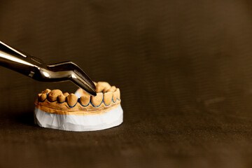 Orthodontic bayonet instrument securing plaster upper jaw model on dark background demonstrating dental procedure accurate handling and clinical dentistry professional workflow © Anton