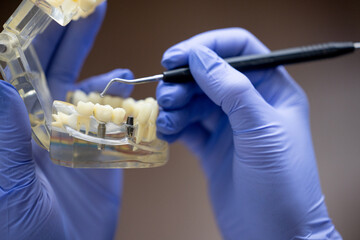 Dental spoon held by dentist over transparent upper and lower jaw typodont highlighting professional dental tools and clinical orthodontic procedure in educational setup © Anton