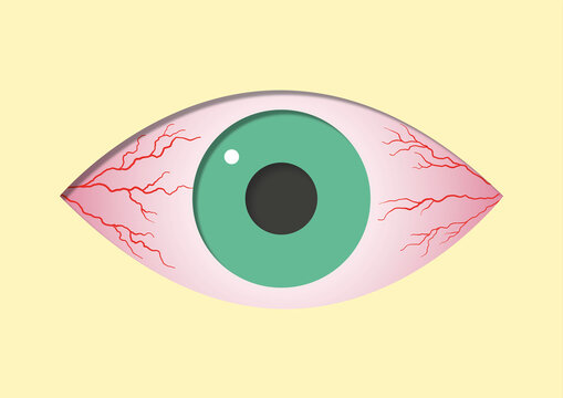 Bloodshot eyes, illustration