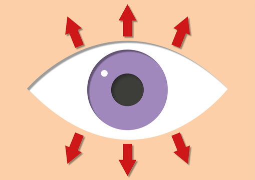 High eye pressure, conceptual illustration