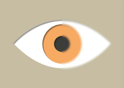 Blurry vision, illustration