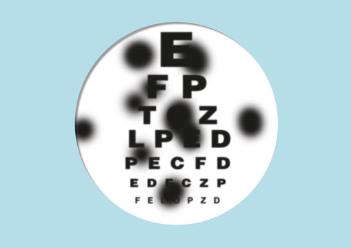 Impaired vision, conceptual illustration