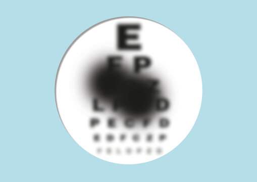 Blurry vision, conceptual illustration