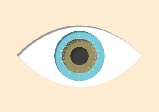 Corneal transplant, illustration