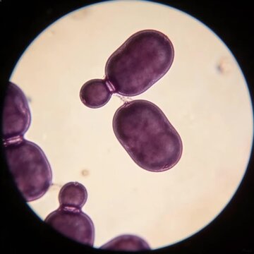 Yeast cells under a microscope, budding reproductive morphology, Gram staining