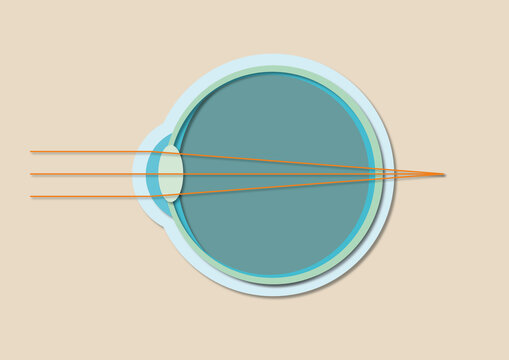 Far-sightedness, illustration