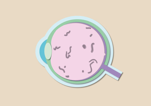 Retinopathy, illustration