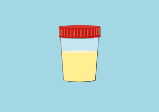 Urine sample, conceptual illustration