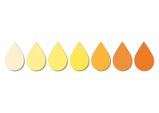 Range of urine colours, conceptual illustration