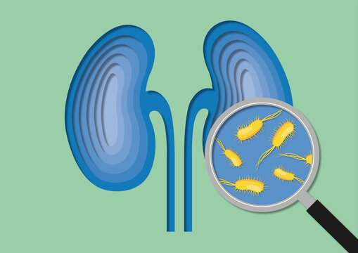 Bacteria within kidney, conceptual illustration