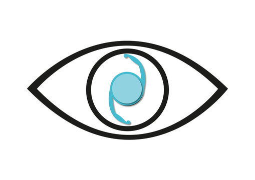 Intraocular lens, conceptual illustration