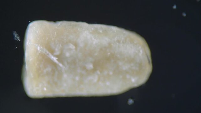 Microscope view of calcified dental plaque extracted from a tooth. Objective 10x. Reflected top illumination. Mineralized biofilm texture and irregular structure of dental calculus on dark background