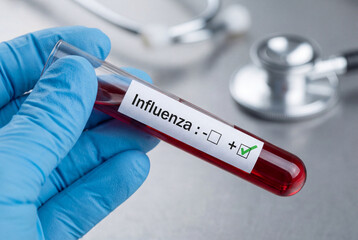 Obraz premium Gloved hand holding test tube with positive influenza result