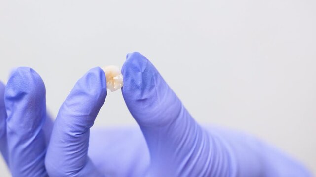 Dentist holding artificial tooth between fingers illustrating dental prosthetic element for restoration treatment tooth replacement and precision clinical dentistry demonstration