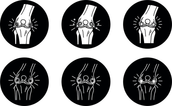 Knee joint pain and arthritis medical icons set with bone inflammation orthopedic vector illustration