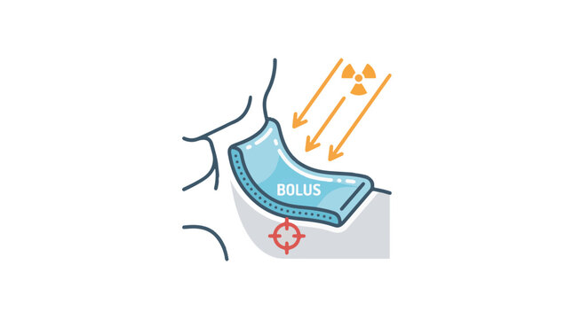 Medical icon illustrating radiation therapy. A blue bolus material is placed on a body surface, with radiation beams (orange arrows) being directed towards a specific target area underneath 