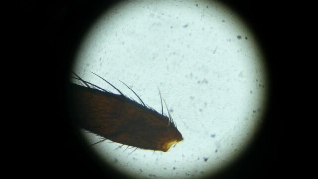 House Fly leg, magnified through microscope