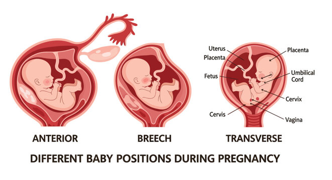 Illustrative vector diagram showing various baby positions inside the uterus during human pregnancy.
