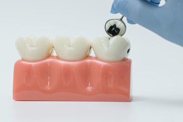 Dental mirror examining severe tooth decay on model