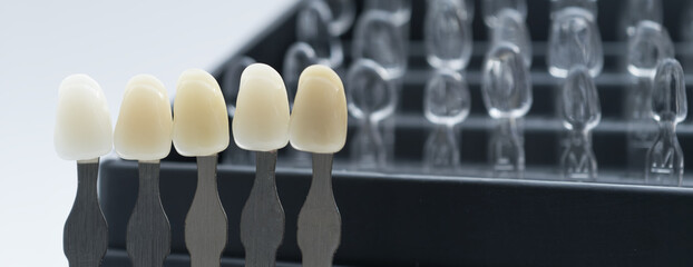 Close-up of dental shade tabs in color tray