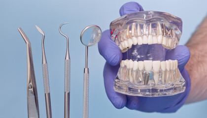 Open Dental Implant Jaw Model with Dentist Instruments and Blue Medical Gloves on Light Blue Background, Prosthetic Dentistry Concept