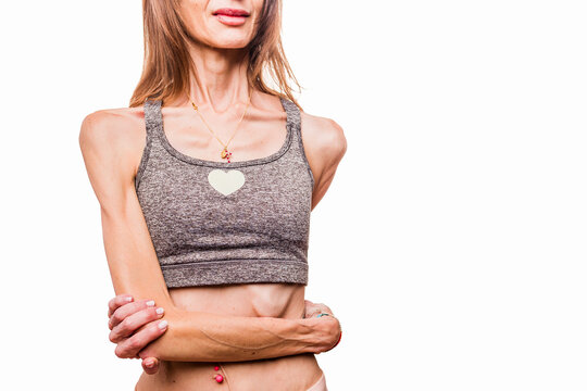 Woman with thin body suffering from anorexia nervosa