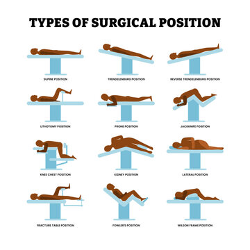 Different types of surgical position for hysterectomy types. Surgical operating table considerations anatomical positioning for patient. after anesthesia administration. Flat vector illustration.
