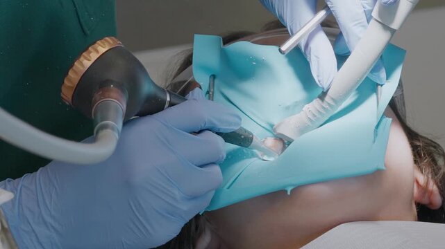 Pediatric stomatologist uses intraoral sandblaster tool with abrasive powder to clean and prepare isolated kid tooth. Air flow hygiene procedure with blue rubber dam and suction.