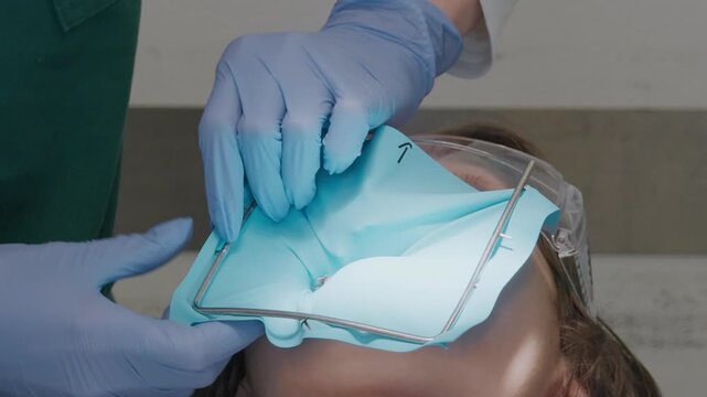 Dentist stretching blue latex rubber dam over metal frame to isolate child surgical area. Professional moisture control technique during pediatric root canal treatment or caries removal.