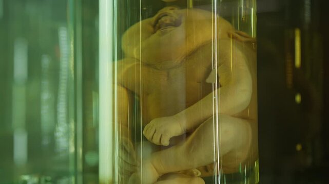 A human infant body with the pathological development of anencephaly in the water.