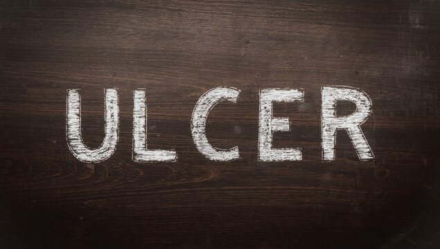 The word "ulcer" inscribed on a wooden chalkboard