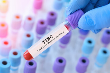 Obraz premium Doctor holding TIBC blood test tube explaining total iron binding capacity for iron deficiency assessment and anemia diagnosis in clinical laboratory medicine concept