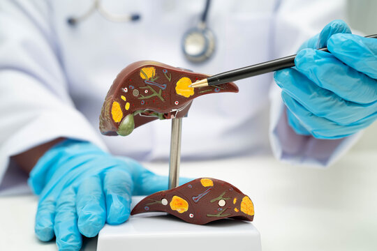 Liver with gallbladder, pancreas spleen and duodenum, Asian doctor holding human anatomy model for study diagnosis and treatment in hospital.