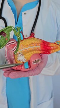 Treatment of gallbladder diseases and cholelithiasis. Doctor demonstrations gallbladder on anatomical medical model for analyzing and treating gallbladder disease concept