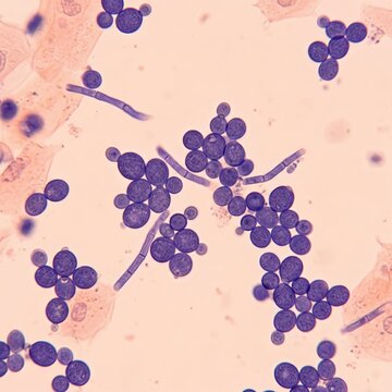 Microscopic View Of Malassezia Furfur Ion Abrasion Scanning Electron Micrograph