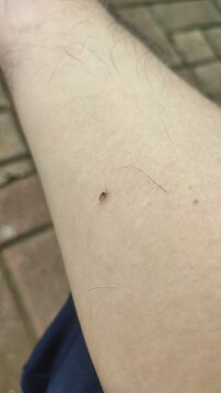 Mosquito Biting Human Skin Close-Up