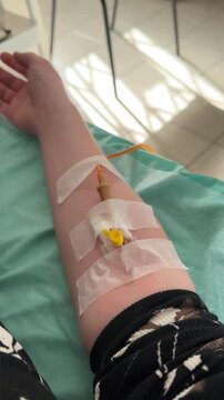 Intravenous catheter inserted into the patient's arm for the administration of fluids or medications. IV drip. Vertical