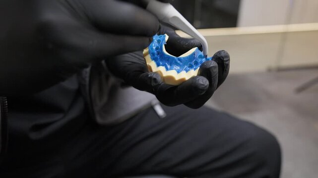 Dentist shaping and refining a dental cast model using a rotary tool, preparing a tooth model for prosthetic restoration in a dental clinic