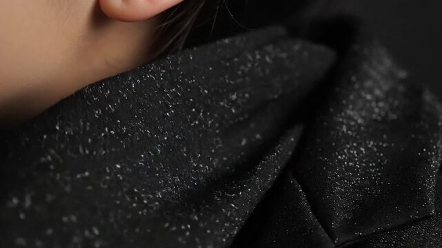 Close-up of dandruff flakes on a person's dark clothing shoulder