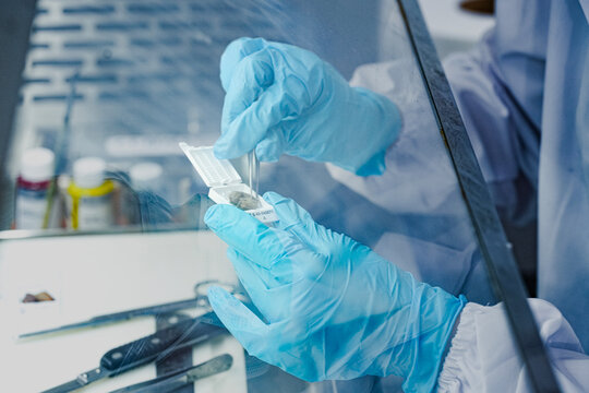 Close-up of scientist hands in gloves using forceps to place tissue sample into cassette. Professional researcher preparing biopsy for histology analysis in sterile lab hood.