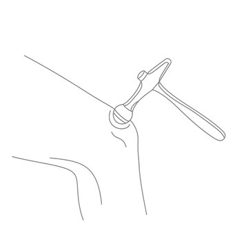 Illustration of a doctor testing knee reflexes with a reflex hammer, showing a medical examination process.
