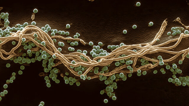 Microscopic examination of intertwined fibers and spherical particles in SEM view