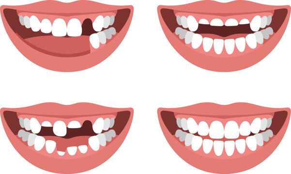Comprehensive Visual Guide to Dental Health, Comparing Missing Teeth, Tooth Loss Patterns, and Successful Restorative Dentistry Outcomes